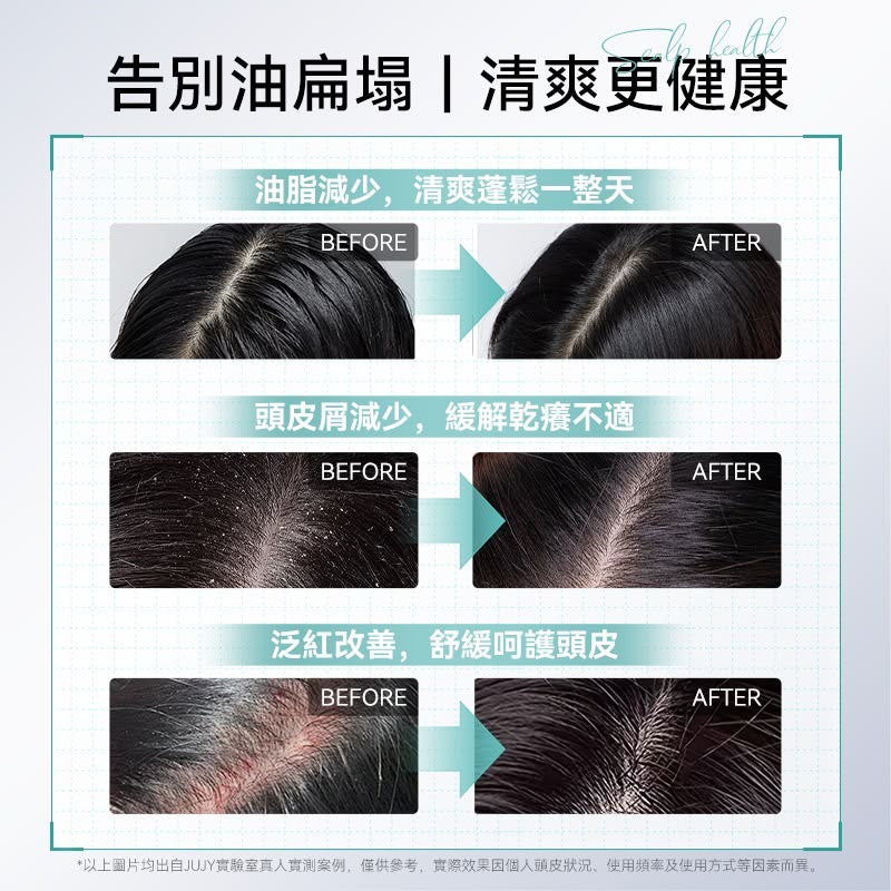 日本JUJY 3D仿人手多點抓揉按摩低頻EMS三色光能滾珠導液密髮增髮梳Pro
