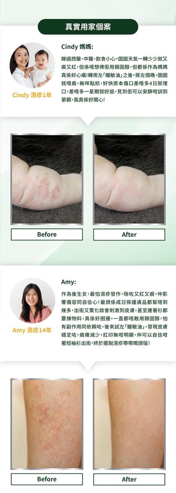 森源 純正鱷敏油50ml